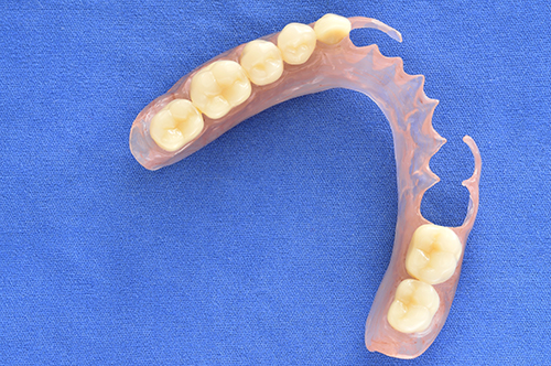 Dentures in Placerville